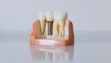 hungary dental implants clinic