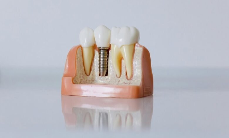 hungary dental implants clinic